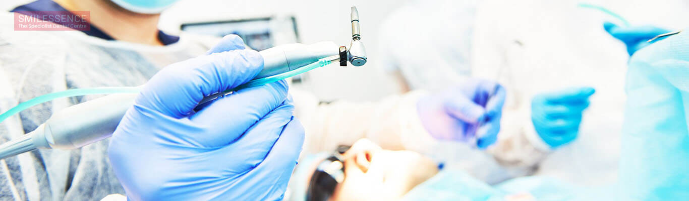 Everything You Need To Know About Dental Implant Surgery