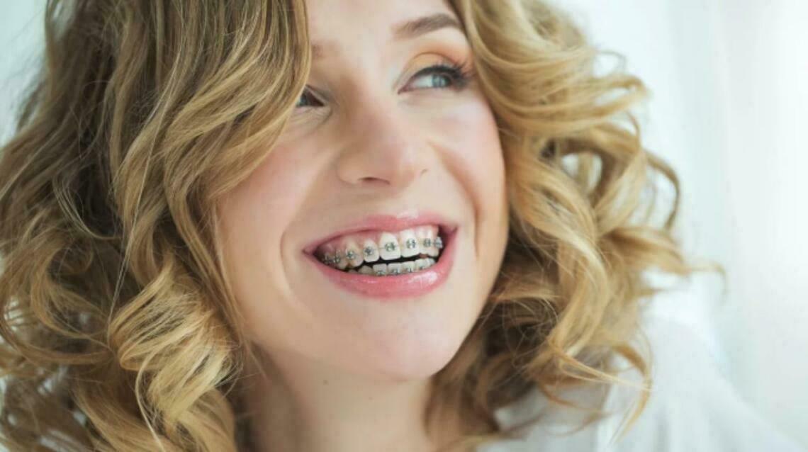 Age No Bar —Braces and Alligners for All Ages ...