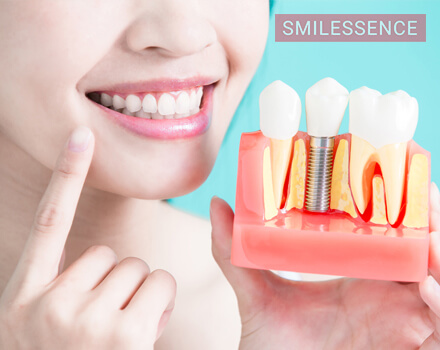 What Makes Smilessence the Best Dental Implant Clinic?