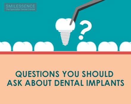 Questions You Should Ask About Dental Implants