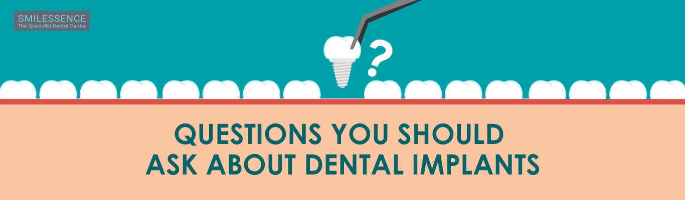Questions You Should Ask About Dental Implants