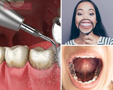 reasons-to-visit-a-dental-implant-clinic