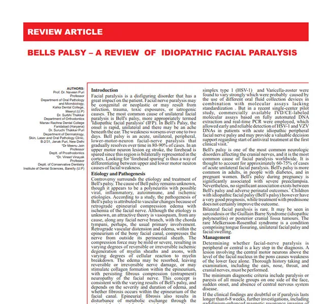 BELLS PALSY