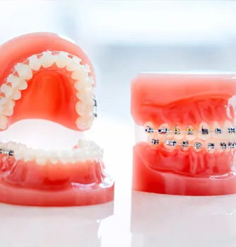 Teeth Braces