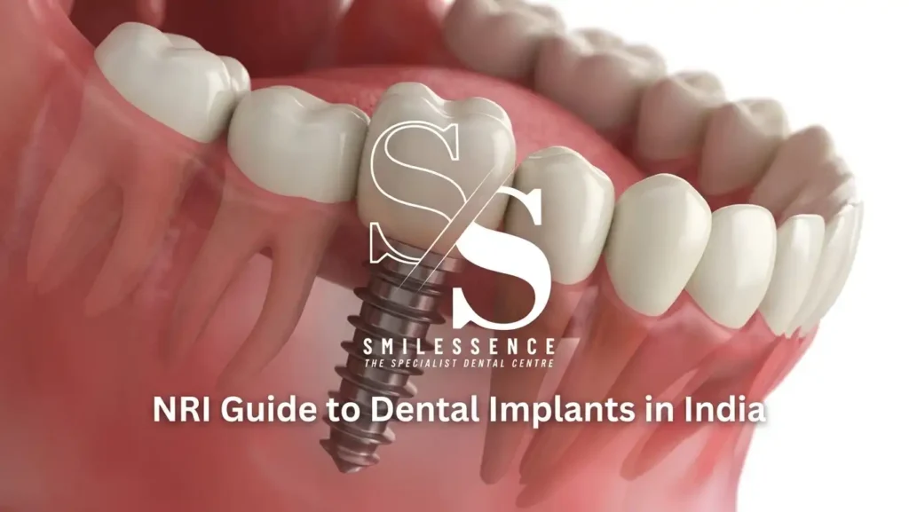 NRI Guide to Dental Implants in India