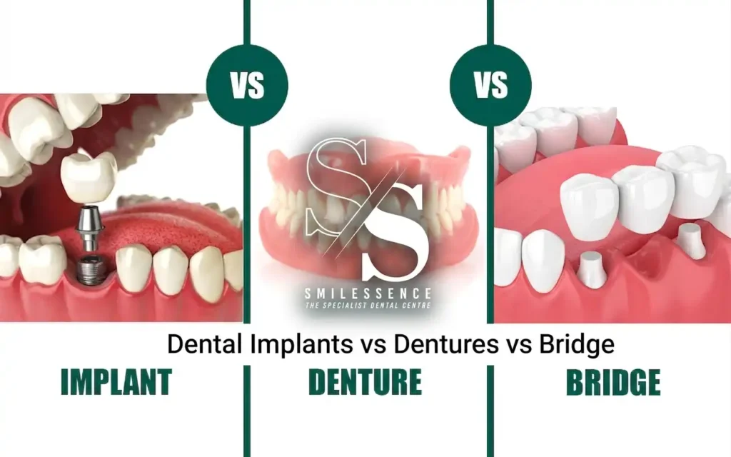 Dental Implants vs Dentures vs Bridge